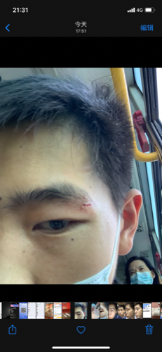 930路公交司机刹车太猛乘客头被磕出血