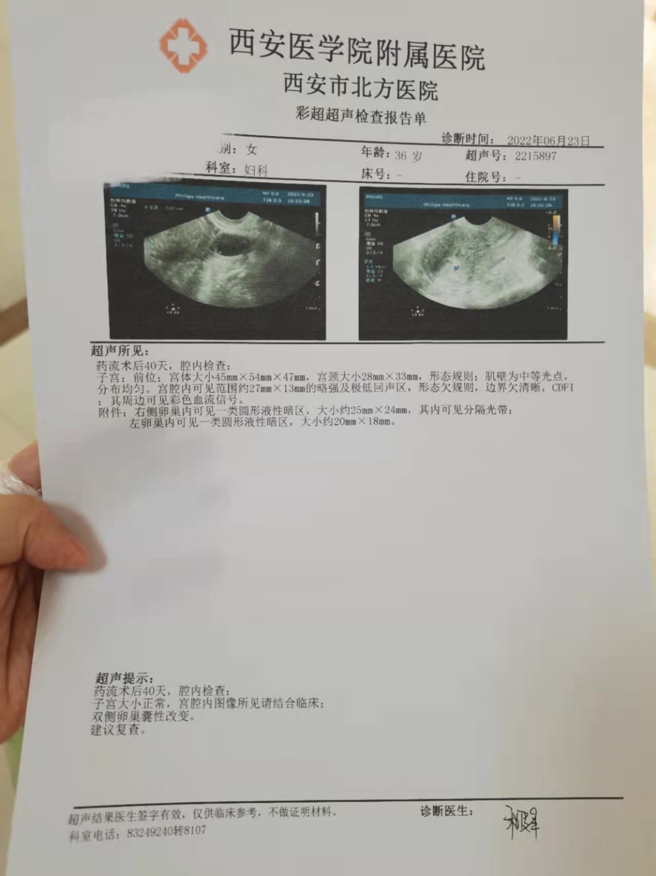 早孕尿检报告单图片图片